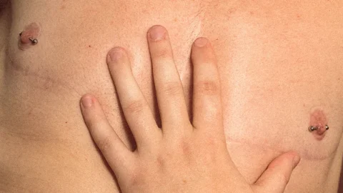 A trans mans chest with a partners hand touching