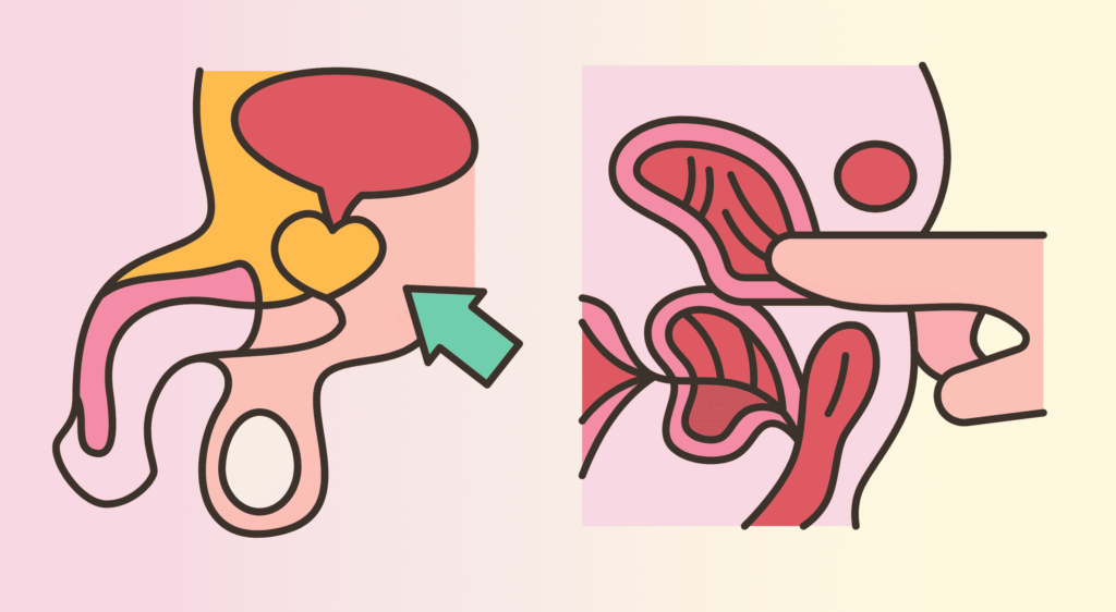 two-cartoon-diagrams-of-prostate-and-stimulation